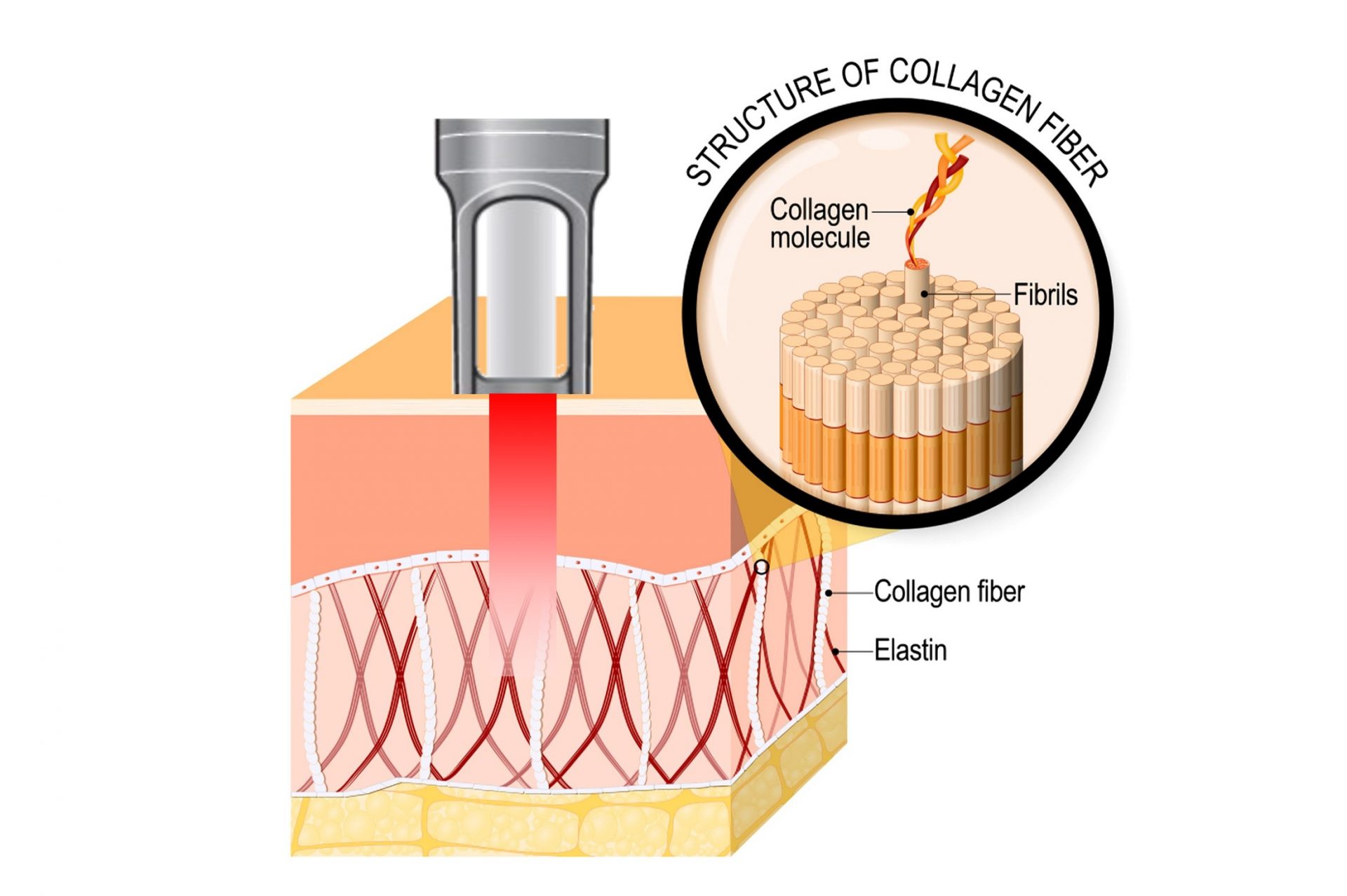 collagen renewal in skin after laser treatment