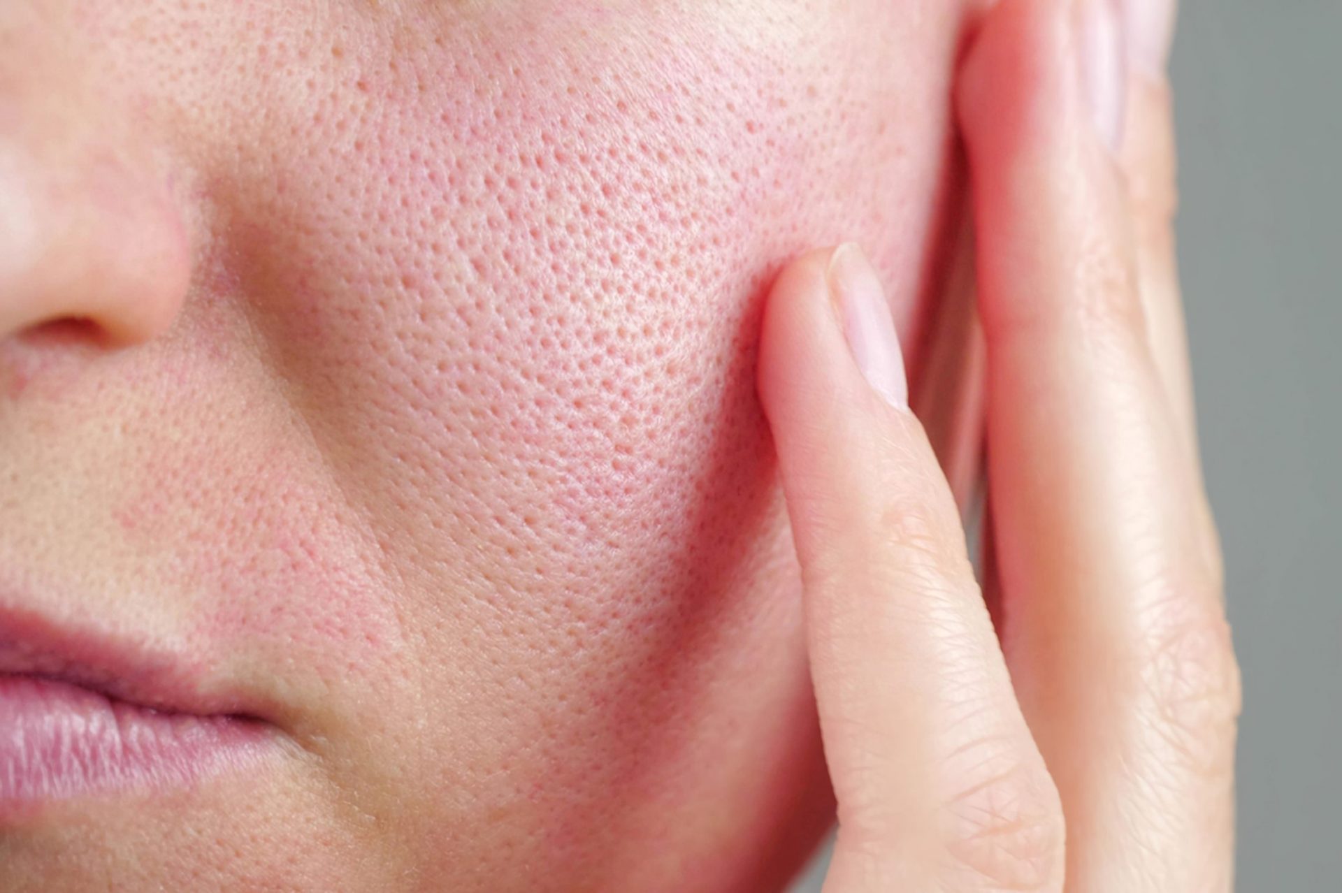 skin condition after laser treatment