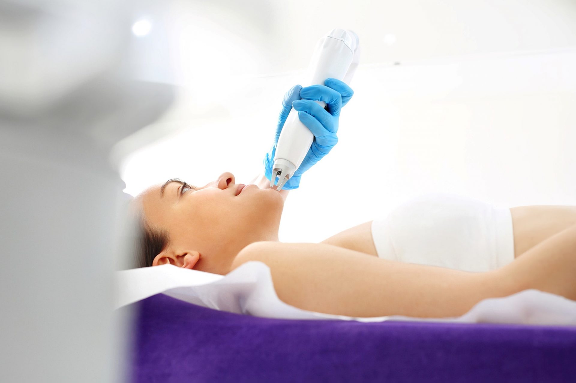 laser treatment for acne scar