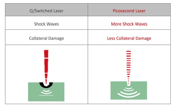pico vs q-switch laser