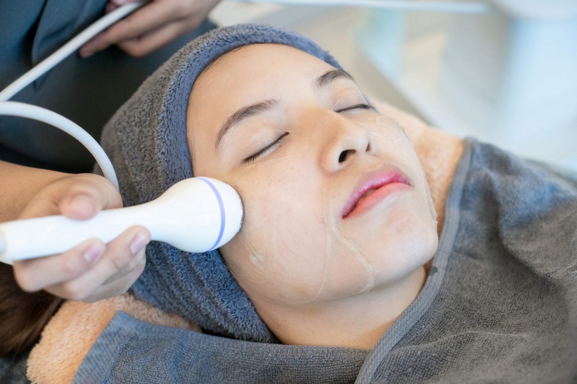 radiofrequency treatment for eye bag removal