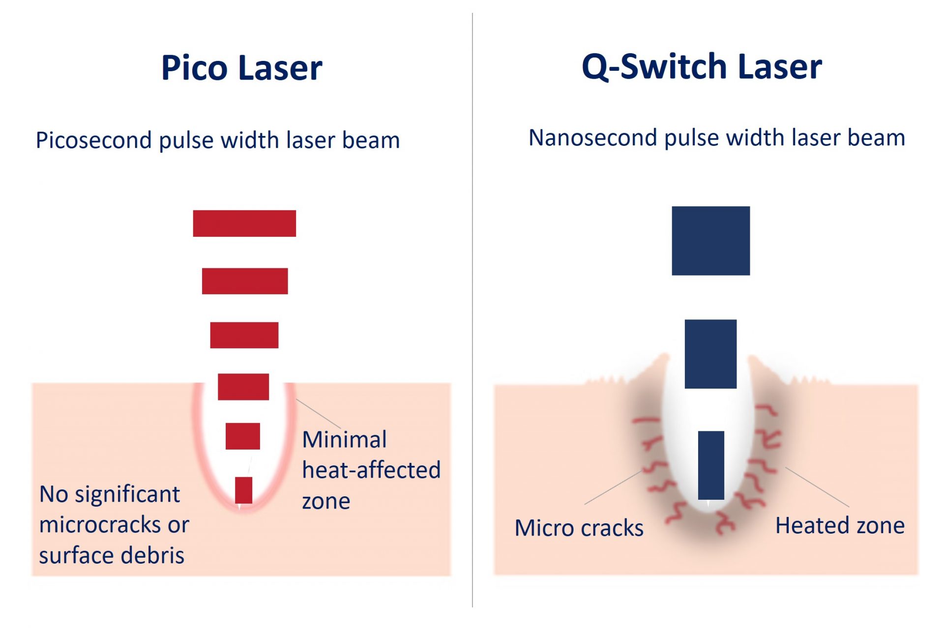 thermal damage of pico laser vs q-switch laser