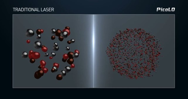 pico laser vs traditional laser