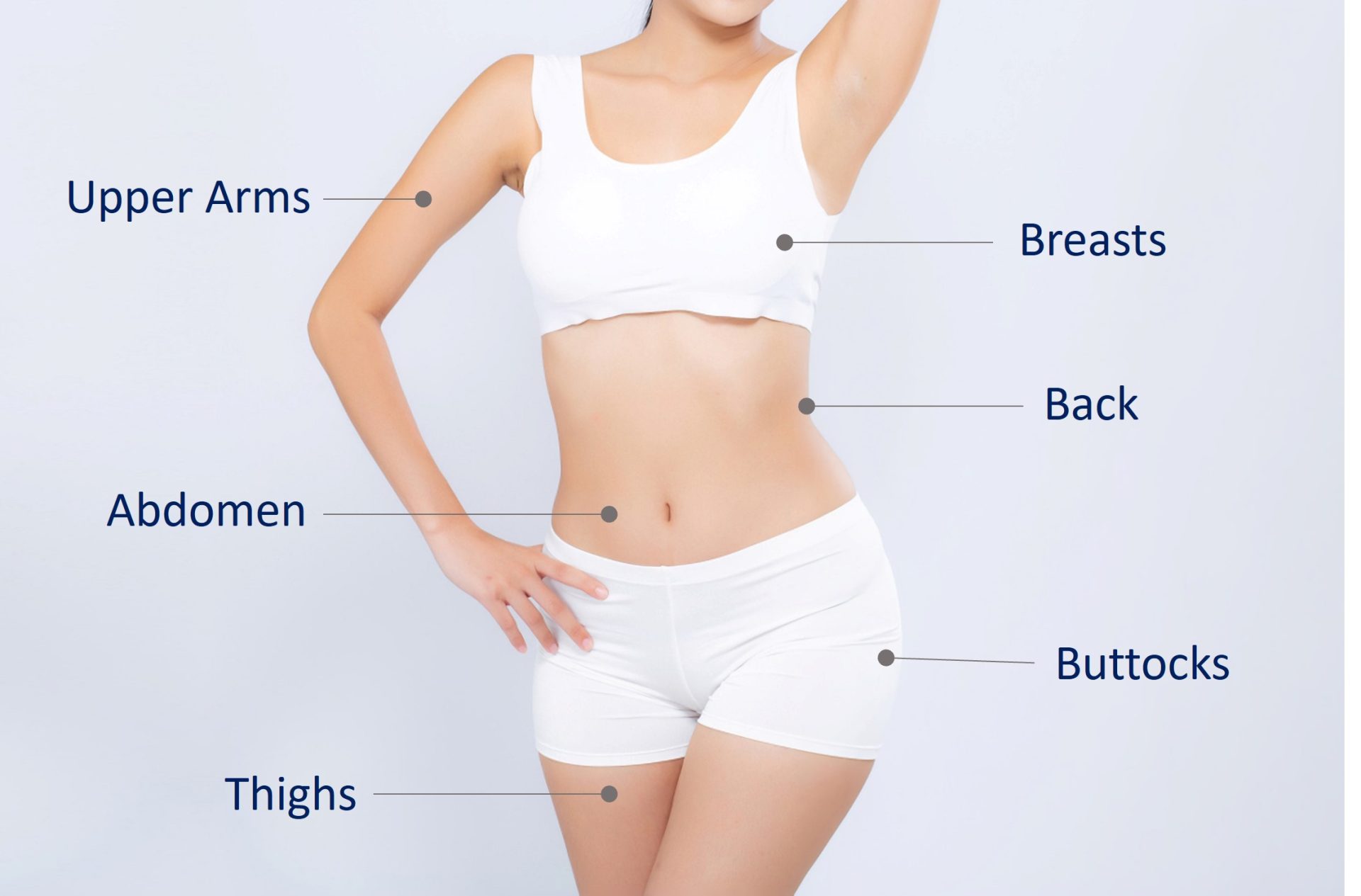 areas which stretch marks can develop