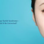 floopy eyelid syndrome - should it be corrected