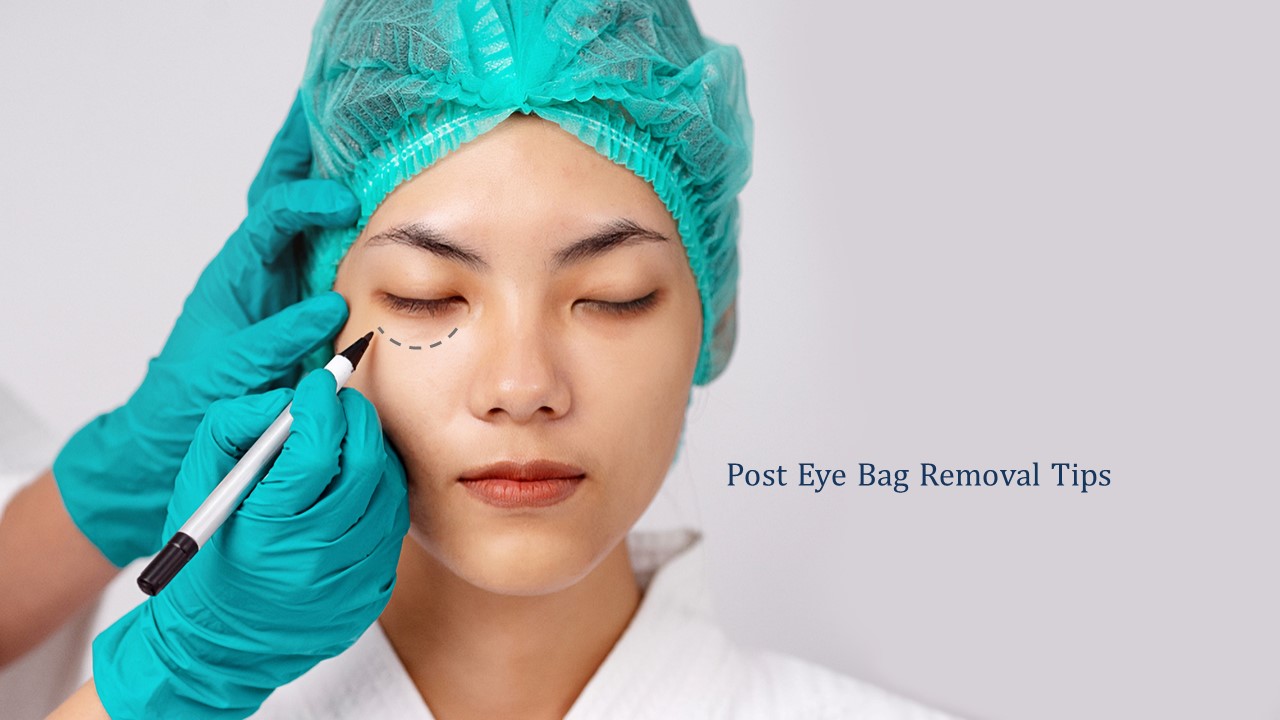 post eye bag removal tips