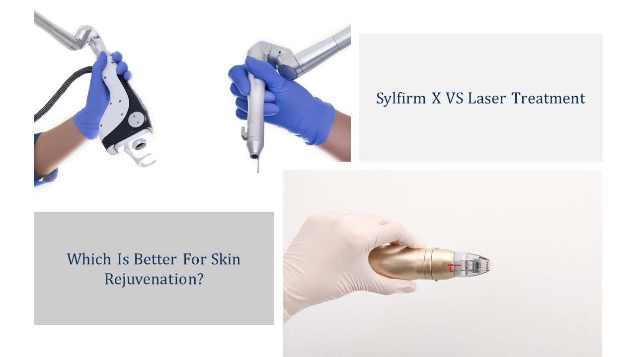 sylfirm x vs laser treatment