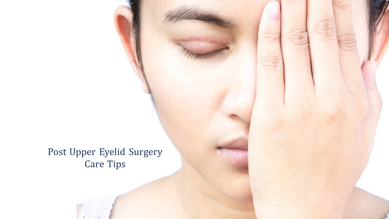 post upper eyelid surgery