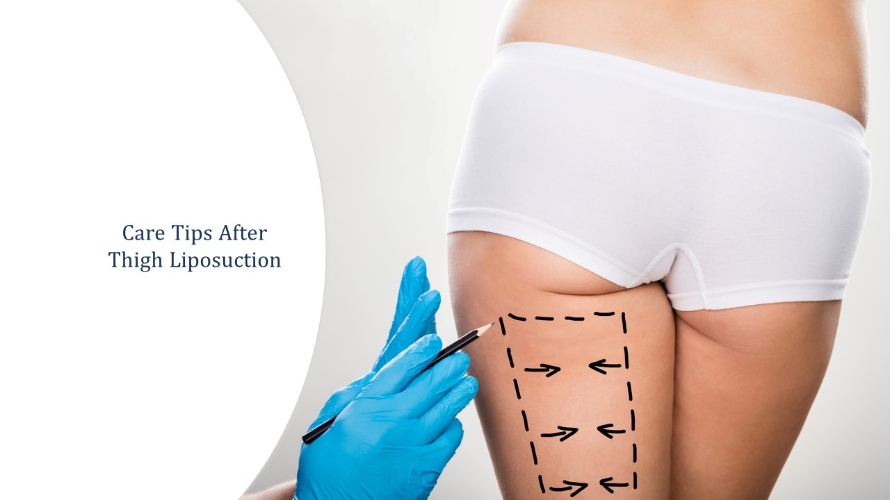care tips after liposuction