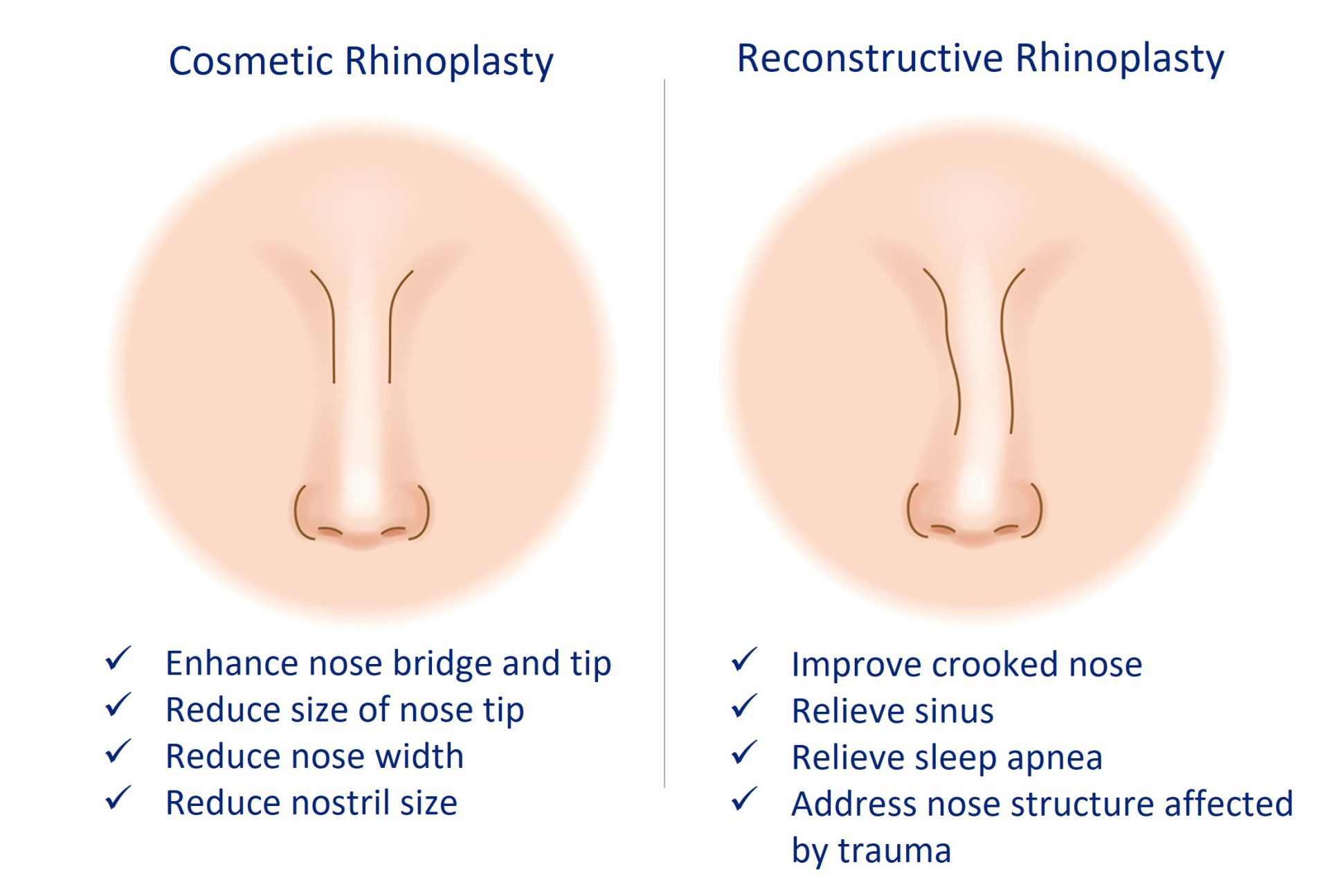 cosmetic versus reconstructive rhinoplasty