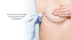 how to choose the right breast implant clinic in singapore