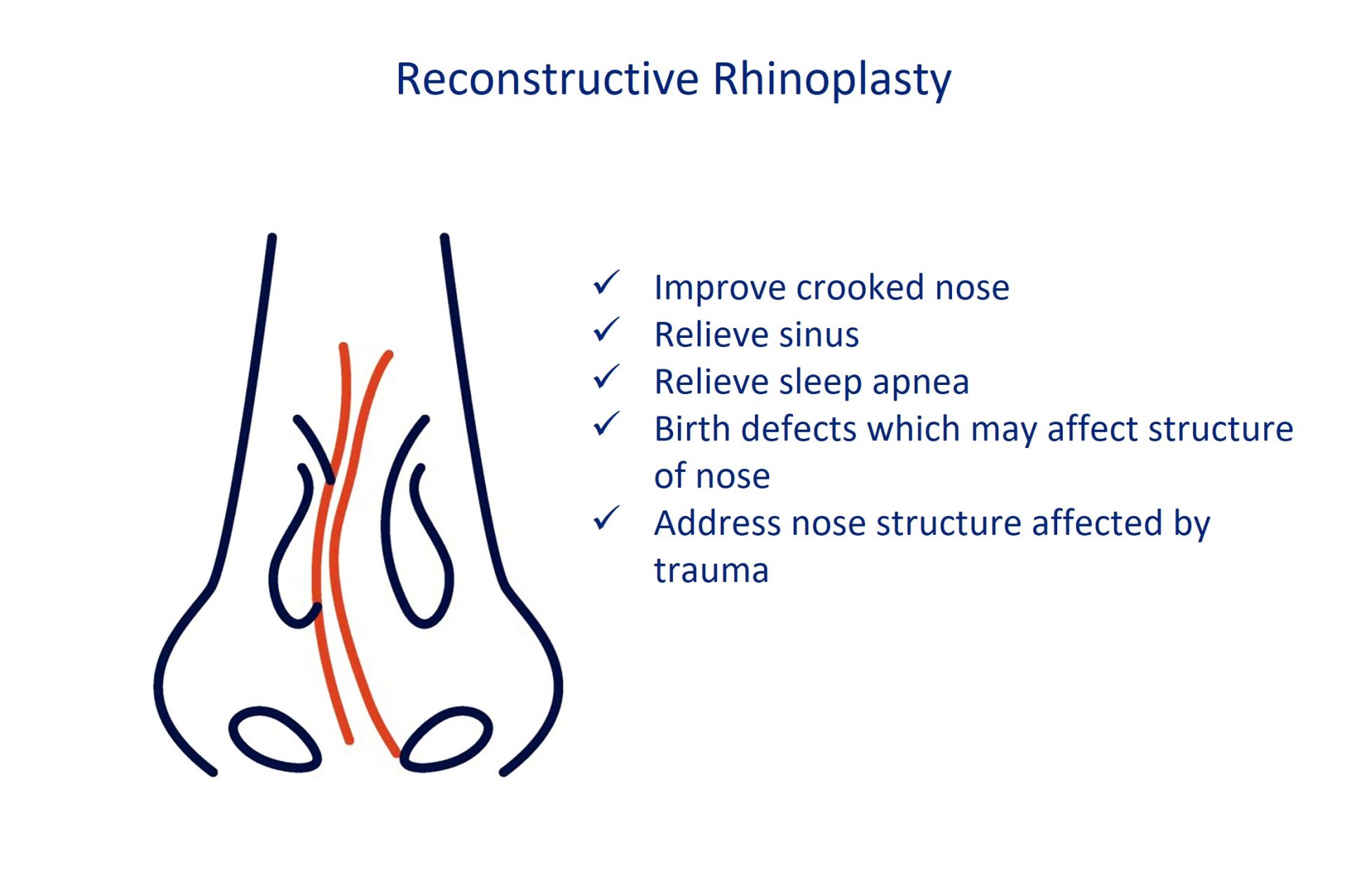 reconstructive rhinoplasty surgery