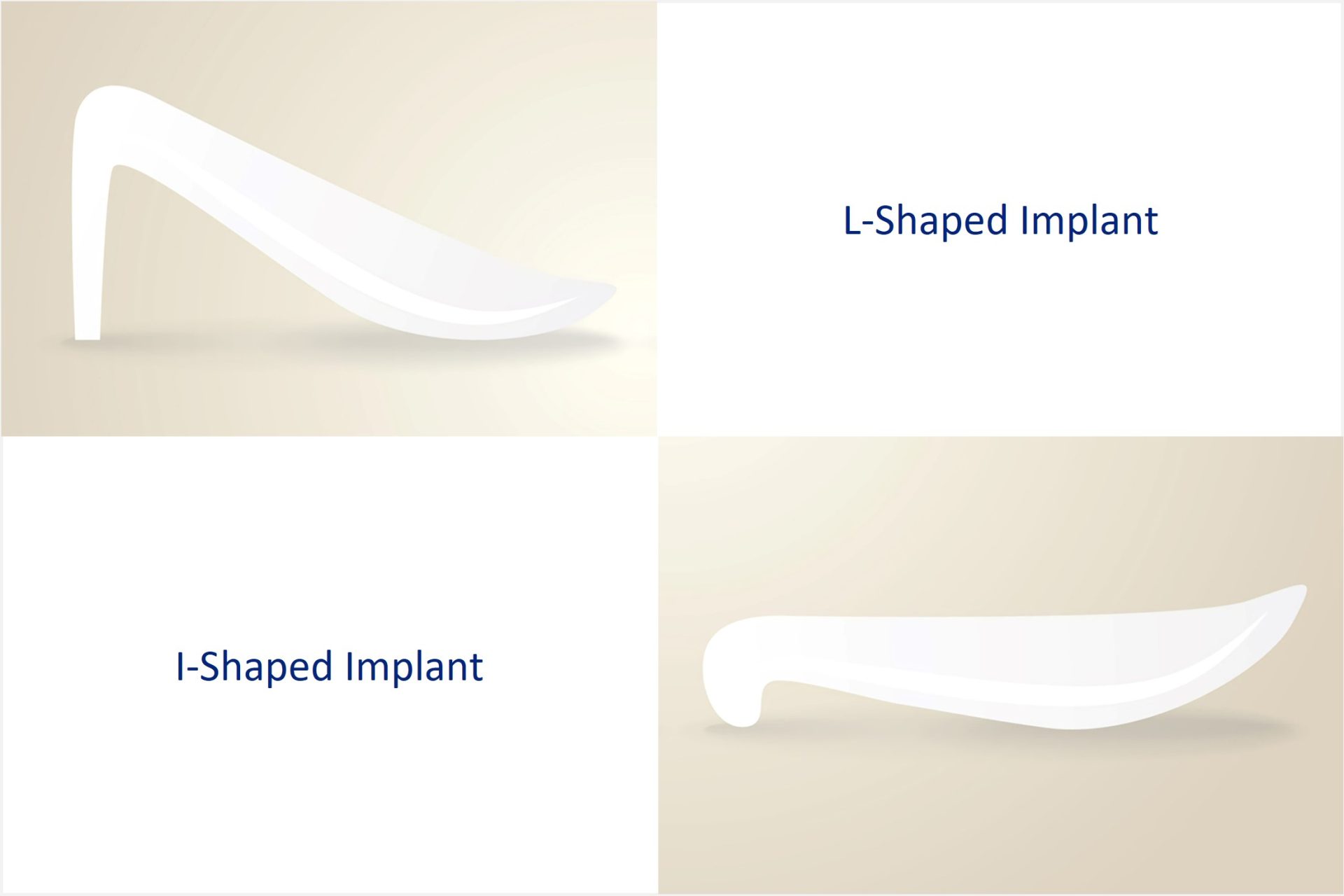 silicone implants for nose surgery - rhinoplasty
