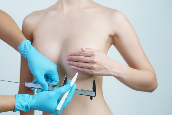 breast augmentation singapore
