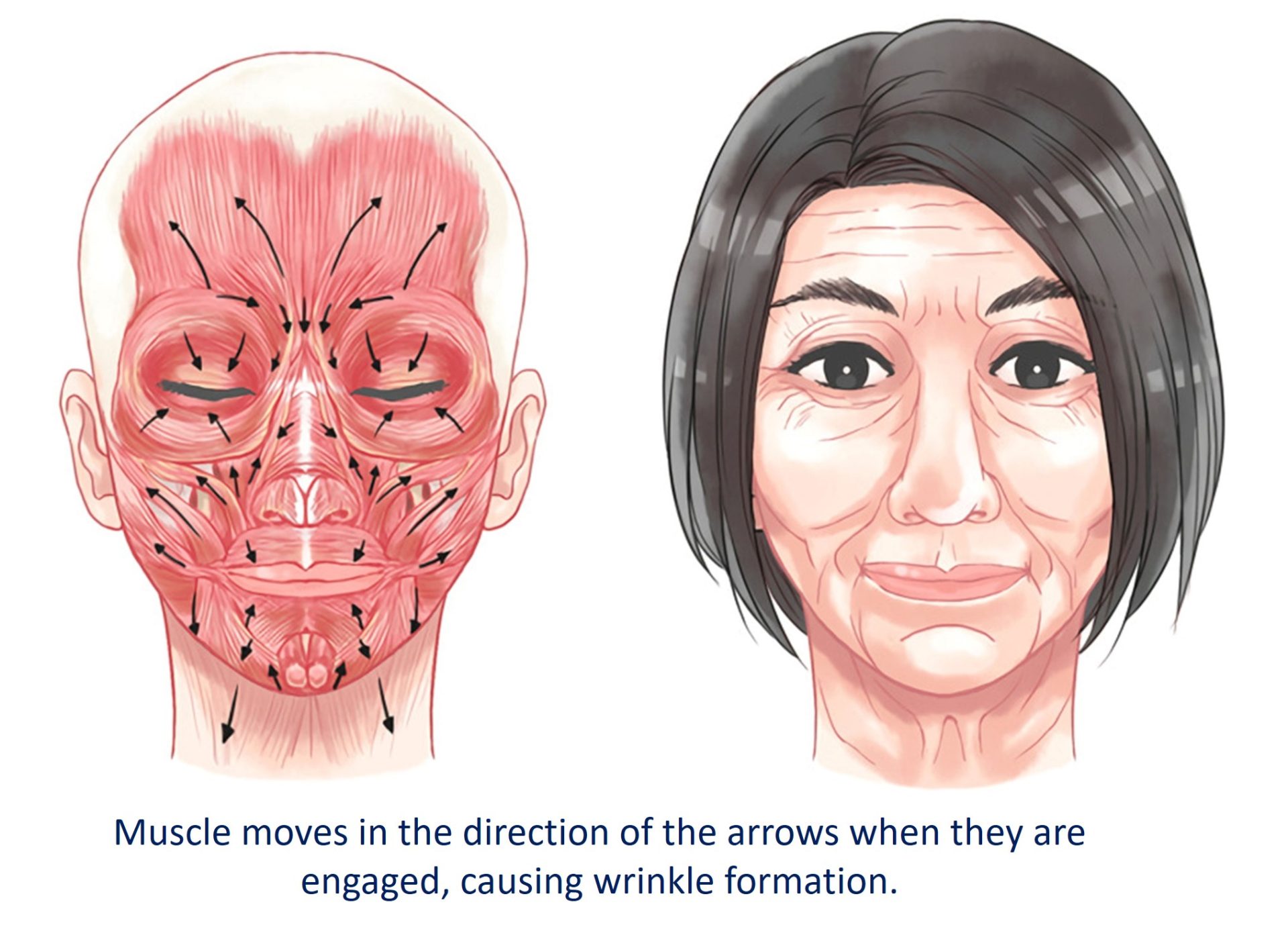 facial muscle movements and wrinkle formation