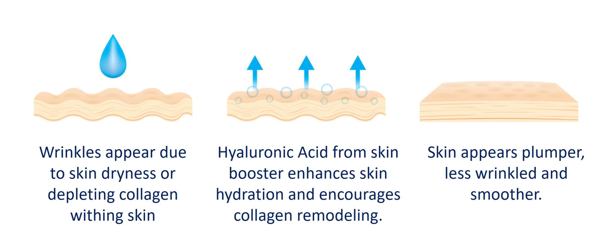 how skin boosters work