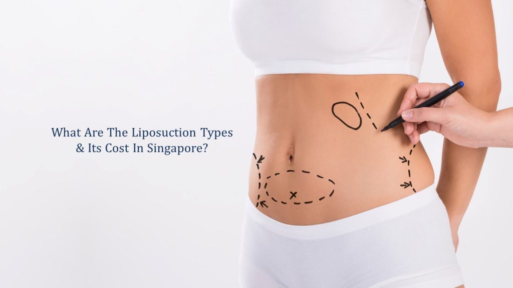 liposuction types in singapore