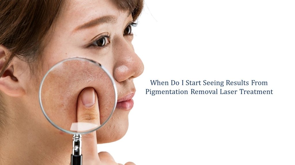 when do i start seeing results from pigmentation laser treatment