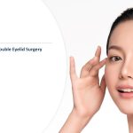 Four Reasons To Get Double Eyelid Surgery