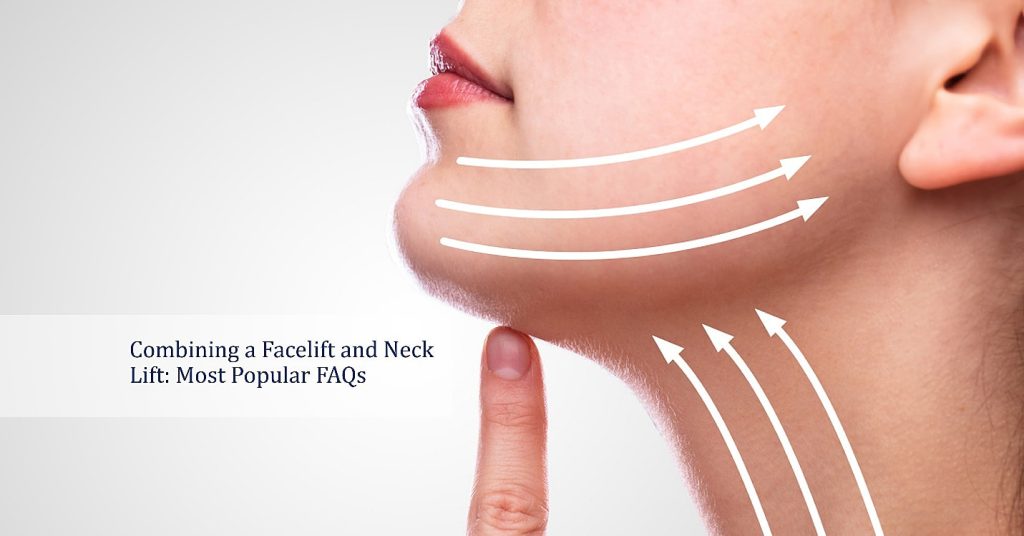 Combining a Facelift and Neck Lift Most Popular FAQs
