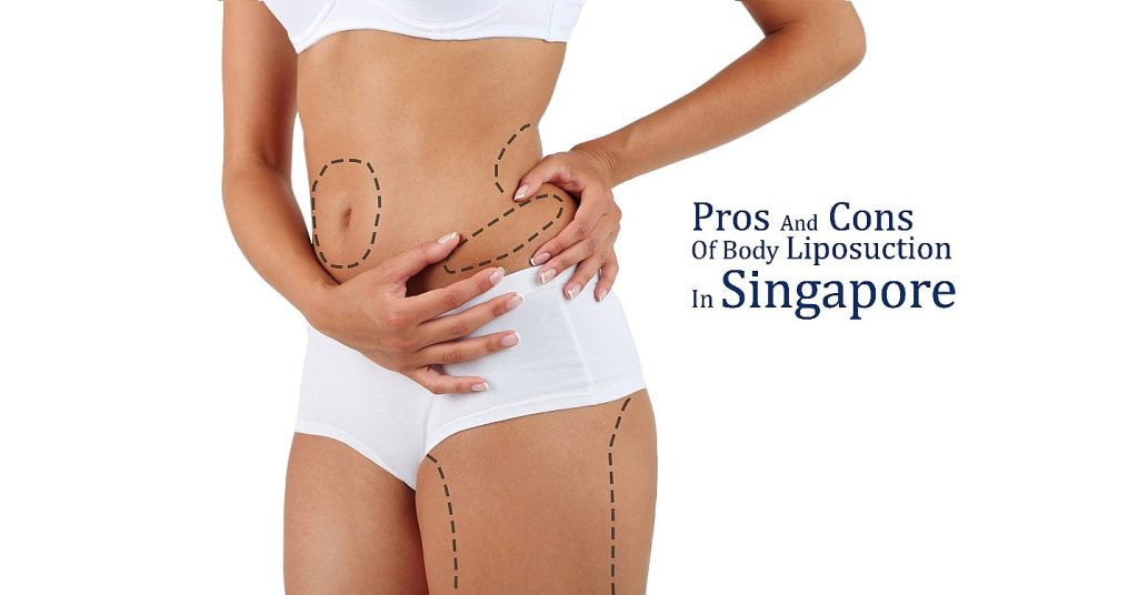 Pros And Cons Of Body Liposuction In Singapore