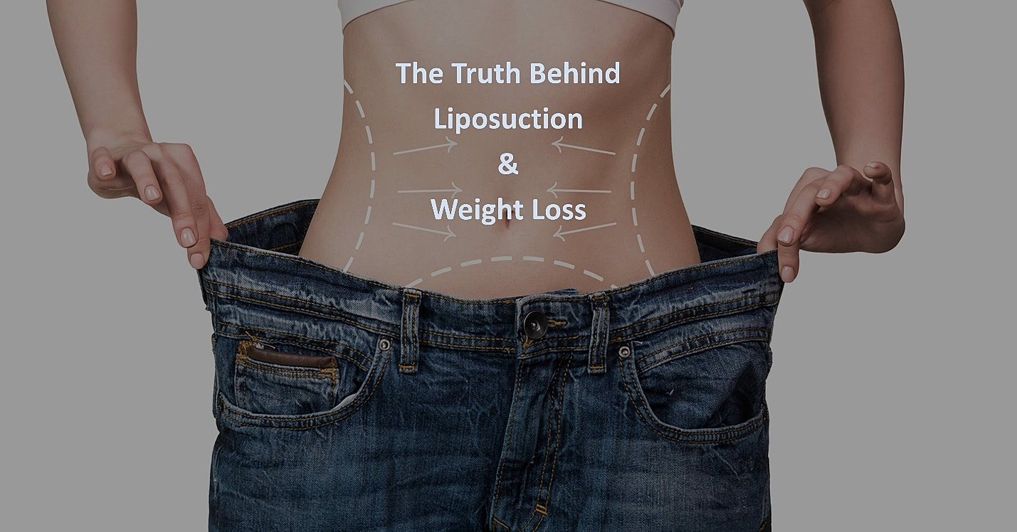 The Truth Behind Liposuction & Weight Loss