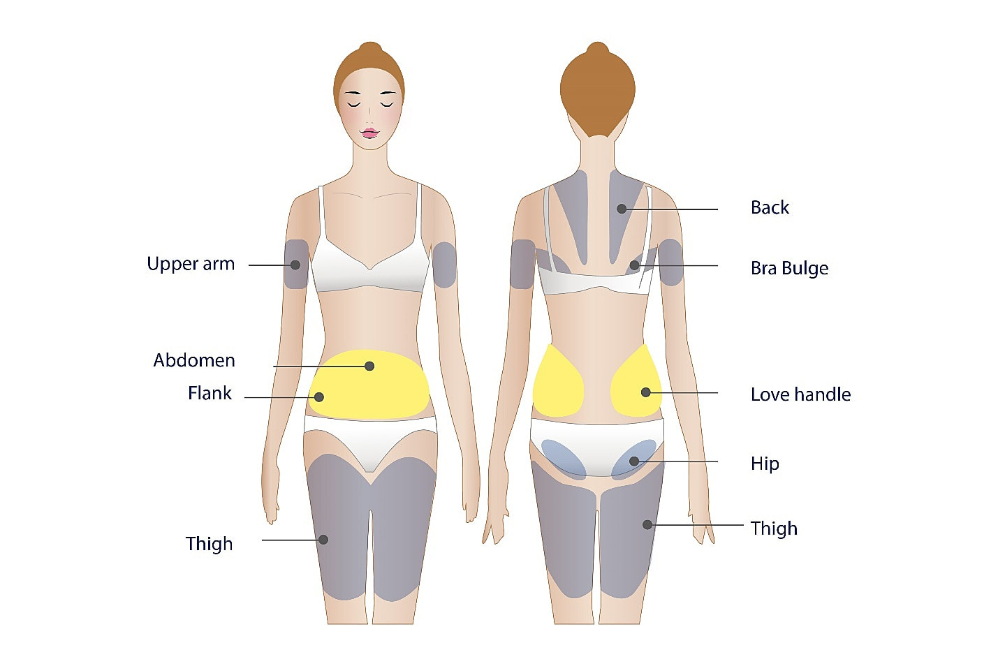 Treatment Areas for Liposuction & Coolsculpting