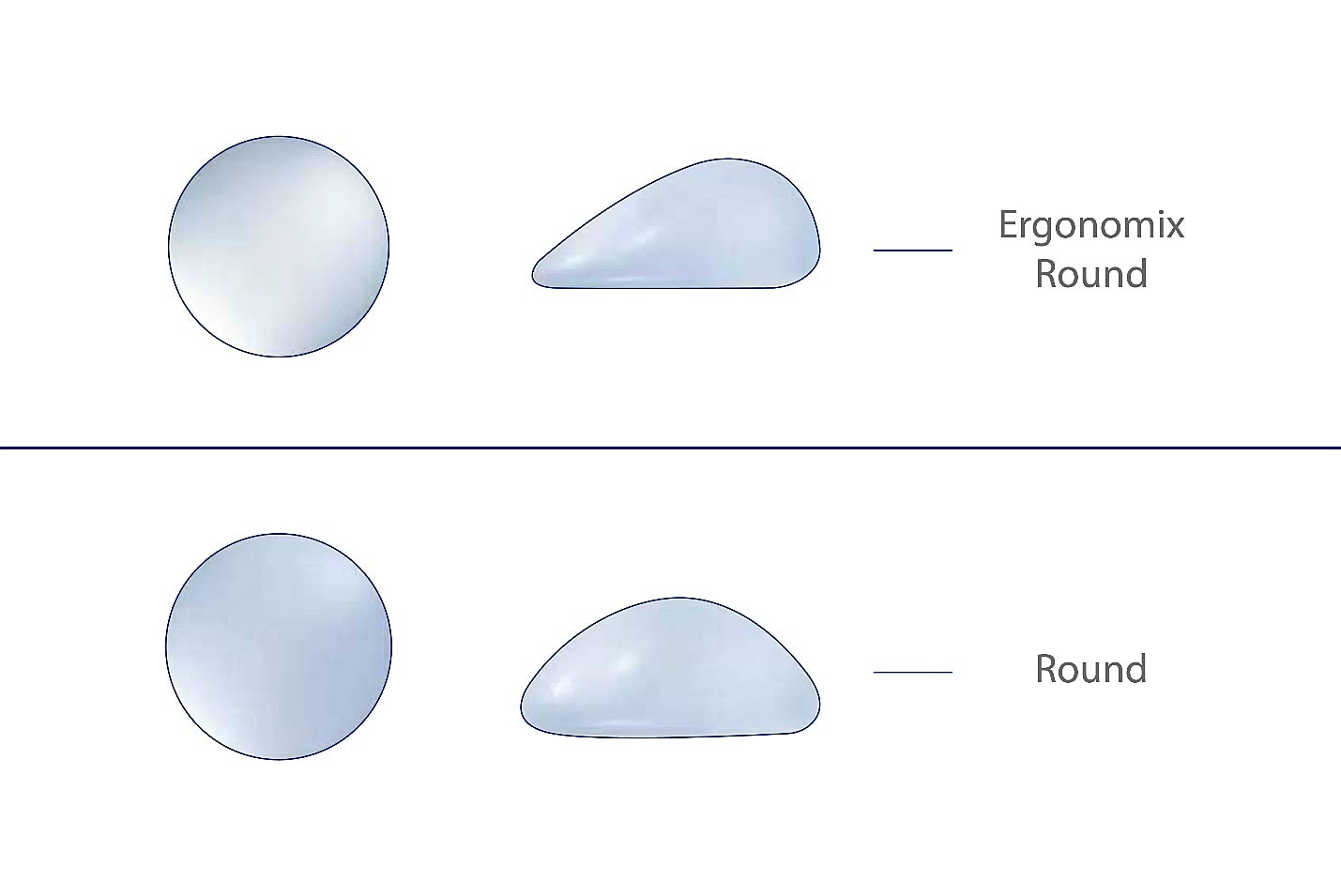 Types Of Breast Implants Available In Motiva