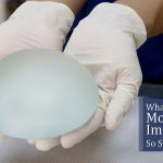 What Makes Motiva Breast Implants So Special