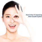 Here's How To Speed Up Recovery After Double Eyelid Surgery