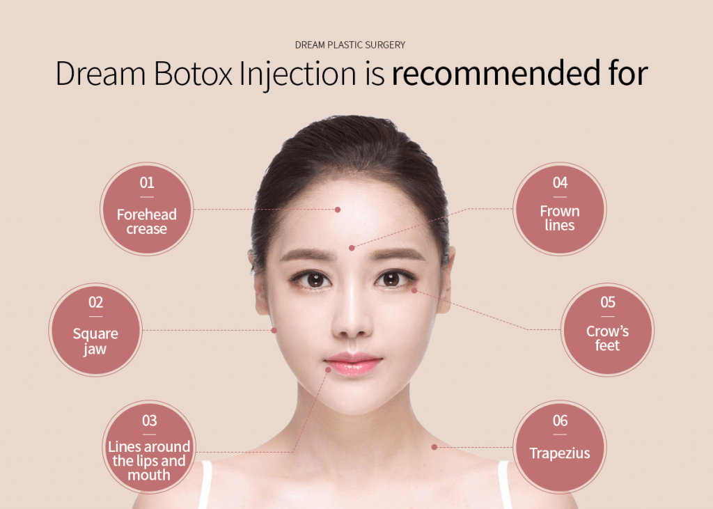 Anti-Wrinkle Injection Singapore - Dream Plastic Surgery