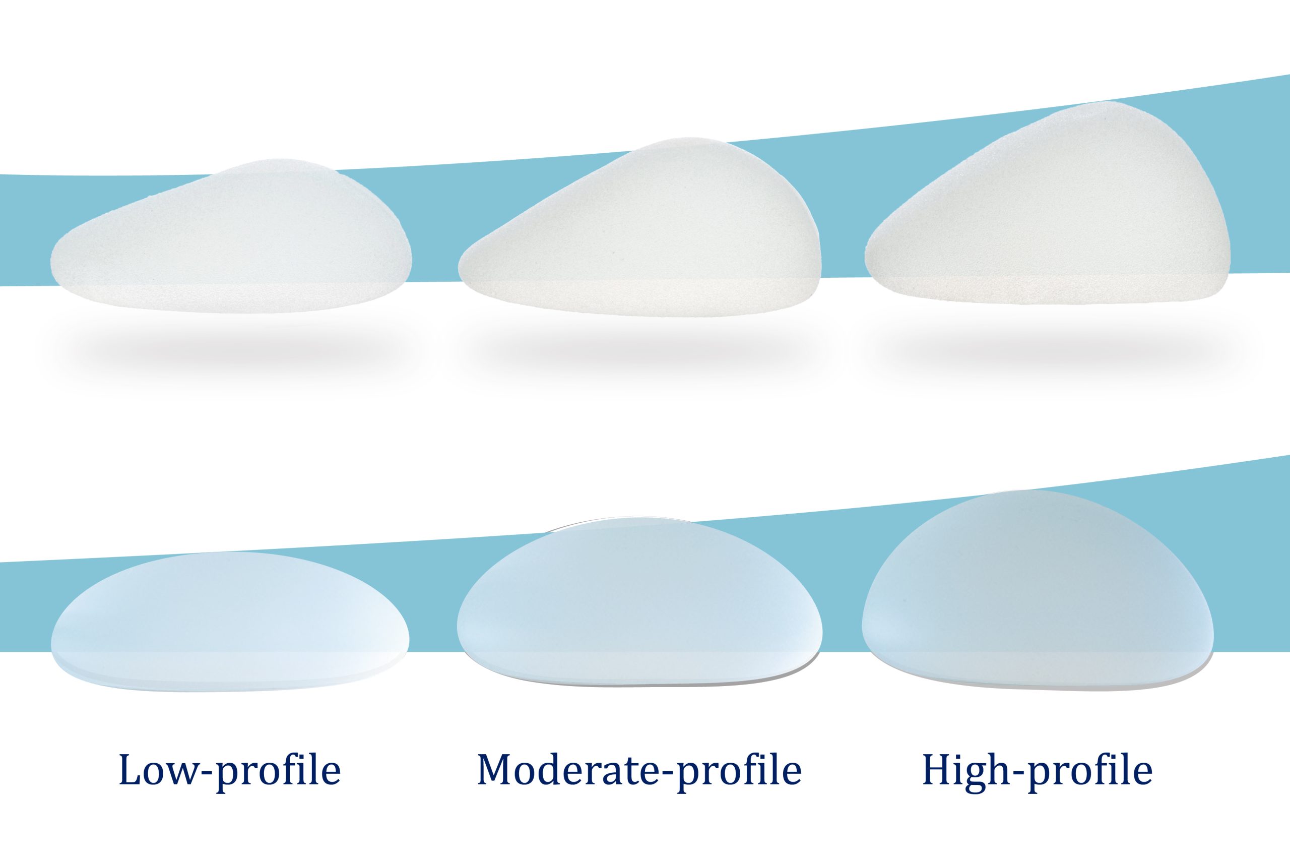 Different profile and shapes for breast implant