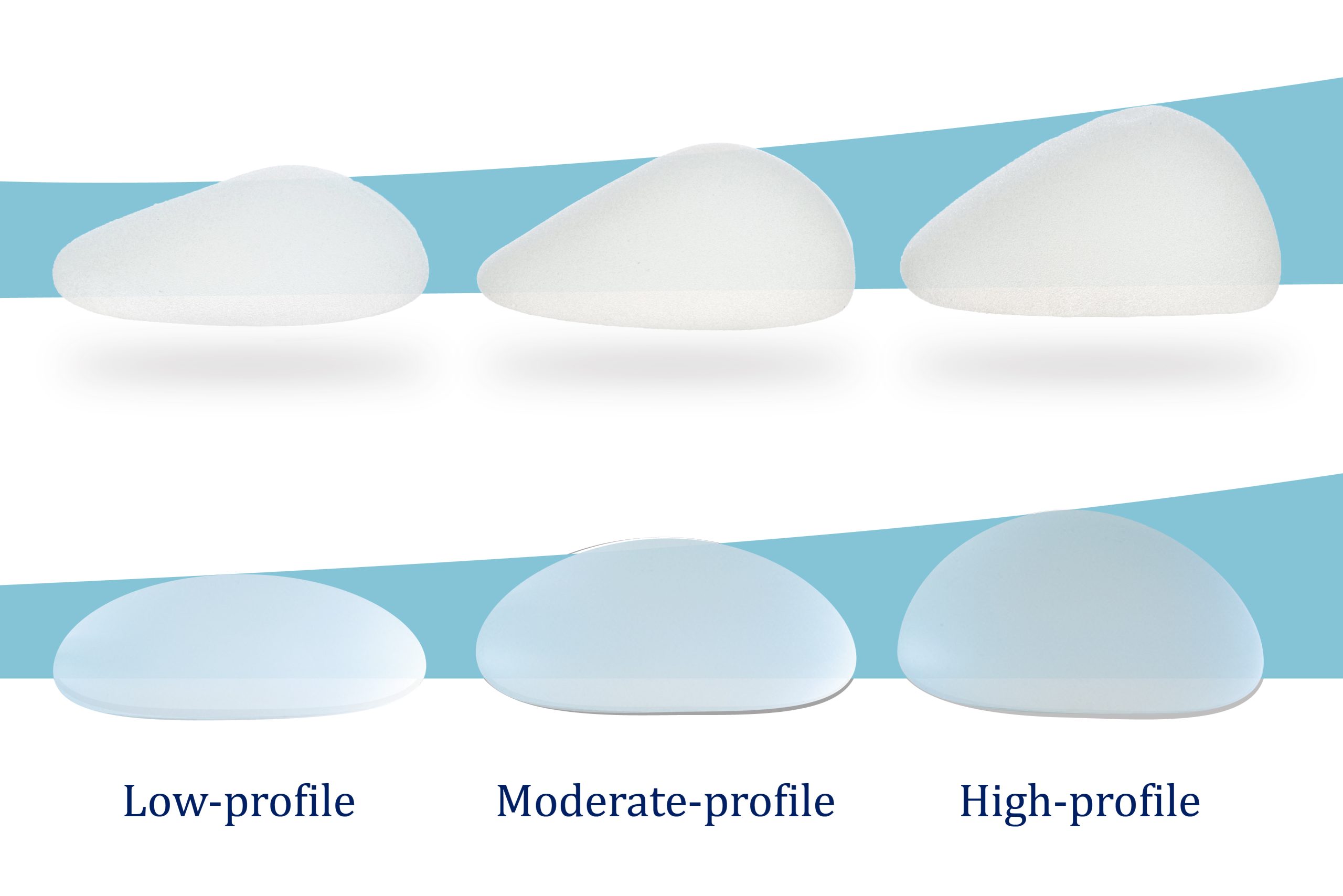 All about Breast Implant Sizes & Profiles