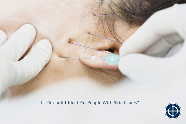 Is Threadlift Ideal For People With Skin Issues