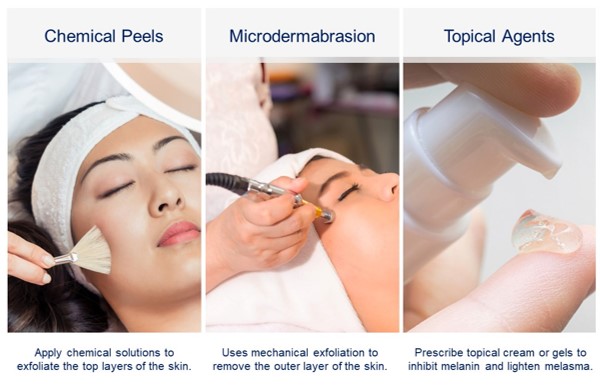 Images of chemical peels, microdermabrasion and topical agents