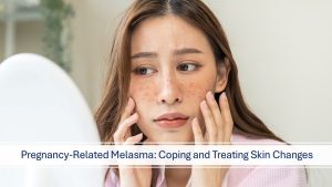 woman with Melasma skin condition