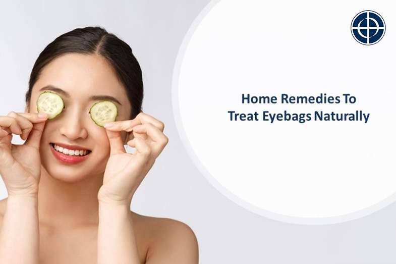 Home Remedies to Treat Eyebags