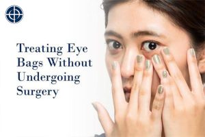 Home Remedies to Treat Eyebags