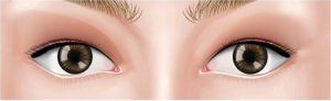 Shallow Double Eyelid