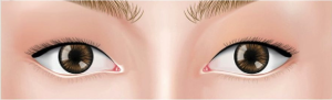 Single Eyelid