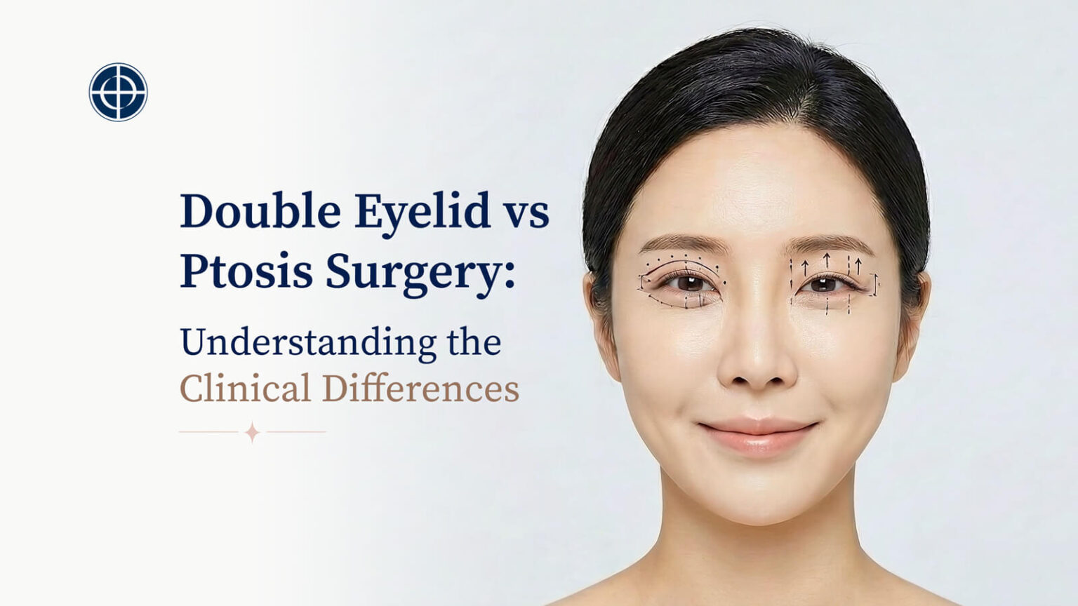 Double-Eyelid-vs-Ptosis-Surgery-Understanding-the-Clinical-Differences-featured-img