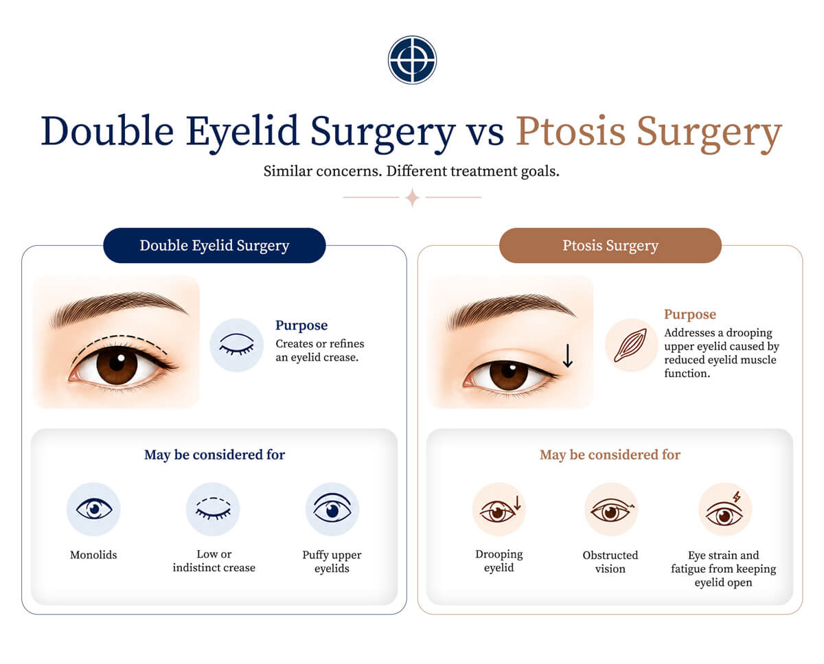 R1-DREAM_Differences-Between-Double-Eyelid-Surgery-and-Ptosis-Surgery-Infographic
