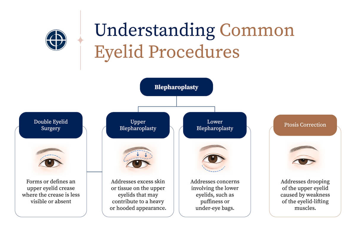 R1-DREAM_Understanding-Common-Eyelid-Procedures--Infographic