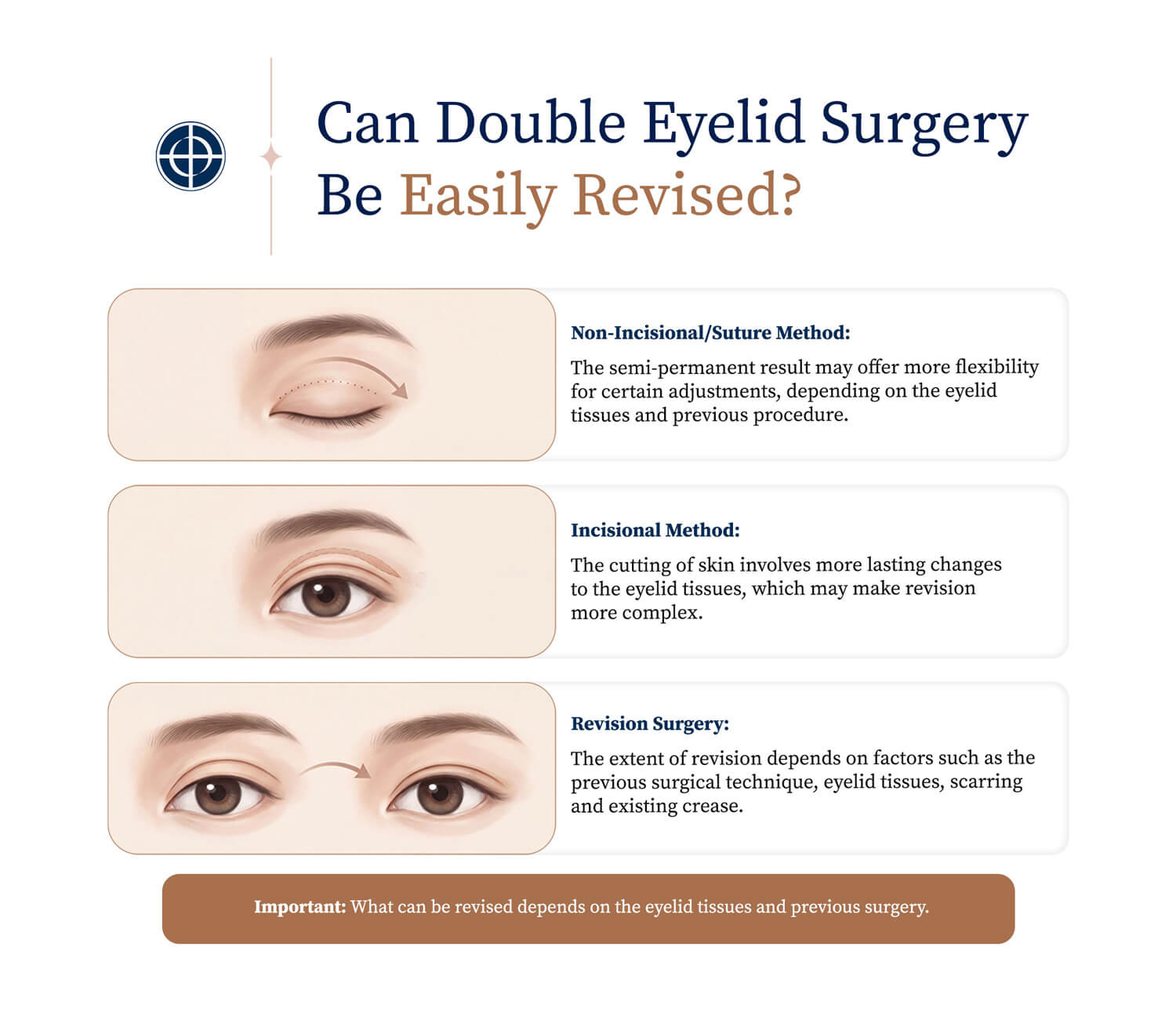 can-double-eyelid-surgery-be-easily-revised-img