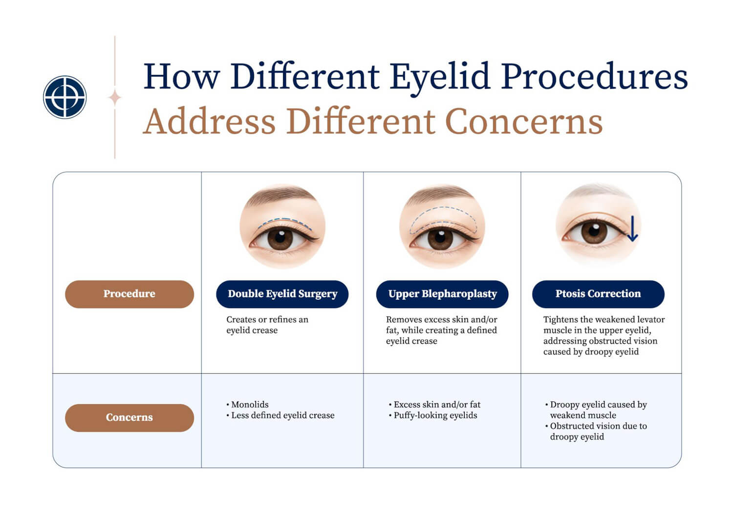 Different Eyelid Concerns, Different Procedures  